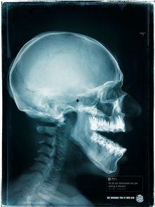 吃瓜下巴脱臼视频真实,网友直呼太真实